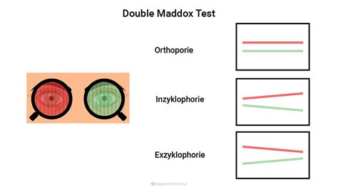 double maddox rod test